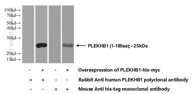 PLEKHB1 Antibody in Western Blot (WB)