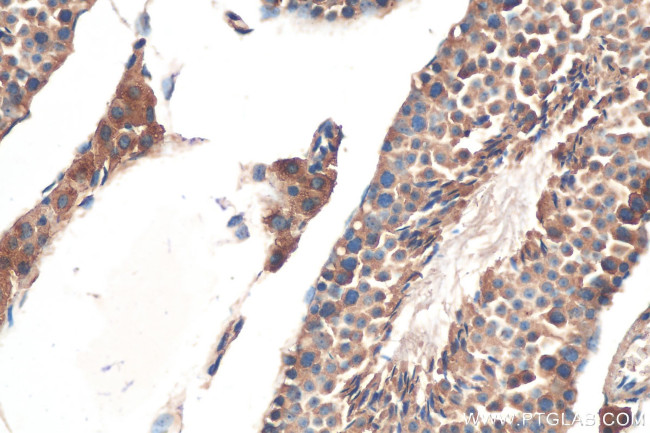 Kallikrein 5 Antibody in Immunohistochemistry (Paraffin) (IHC (P))