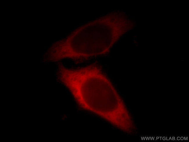 LASP1 Antibody in Immunocytochemistry (ICC/IF)