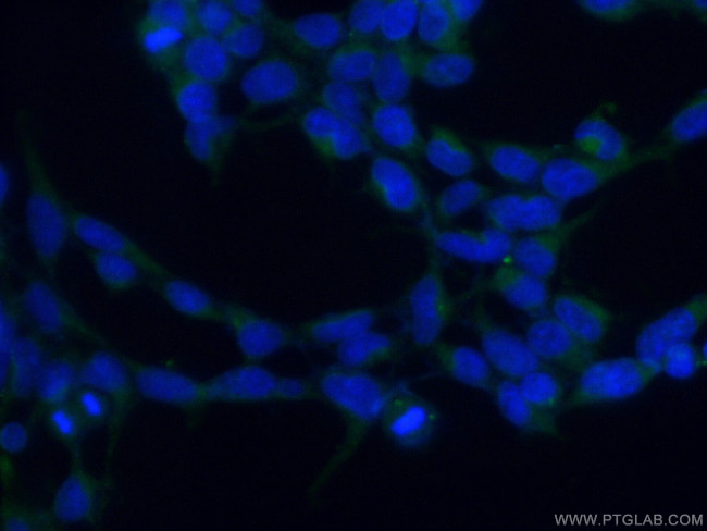 PCMT1 Antibody in Immunocytochemistry (ICC/IF)