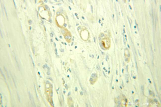 APOD Antibody in Immunohistochemistry (Paraffin) (IHC (P))