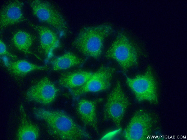 CRMP5 Antibody in Immunocytochemistry (ICC/IF)