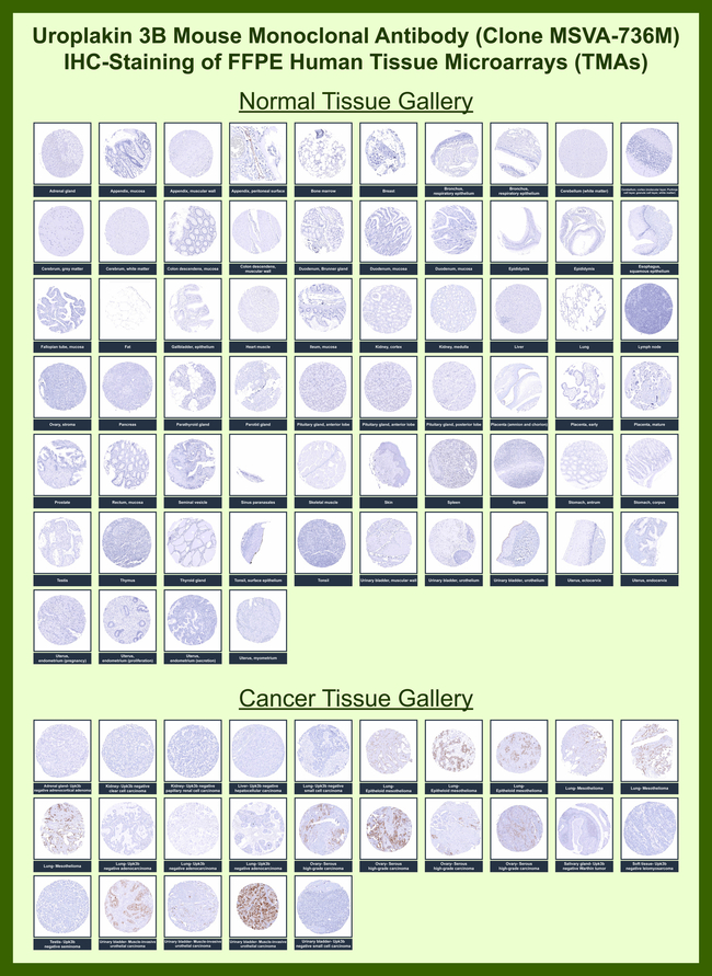 Uroplakin 3B (UPK3B) (Marker of Mesothelial & Umbrella Cells) Antibody in Immunohistochemistry (Paraffin) (IHC (P))