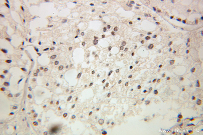 GTF2A2 Antibody in Immunohistochemistry (Paraffin) (IHC (P))