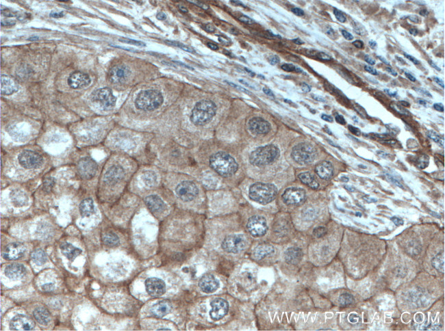 Calmodulin Antibody in Immunohistochemistry (Paraffin) (IHC (P))