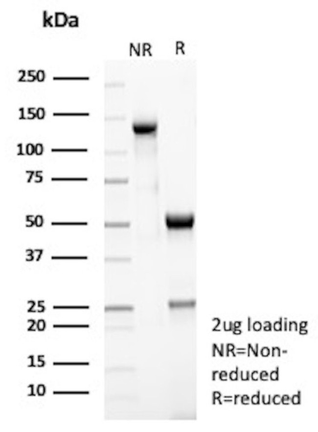 Peroxiredoxin 4 (Prognostic Marker for Lung SqCC) Antibody in SDS-PAGE (SDS-PAGE)