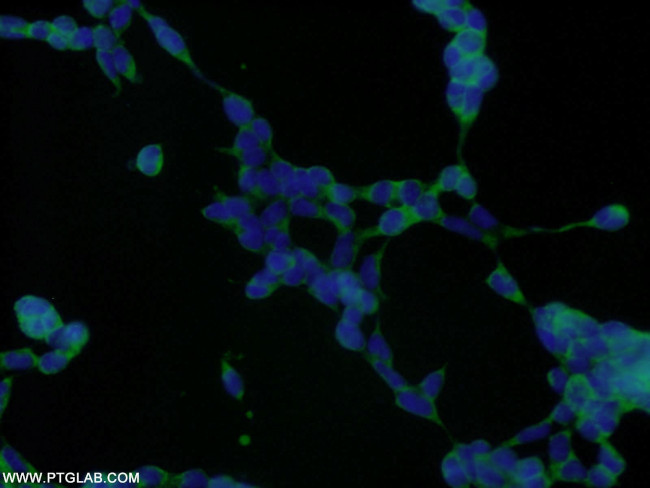 RNPS1 Antibody in Immunocytochemistry (ICC/IF)