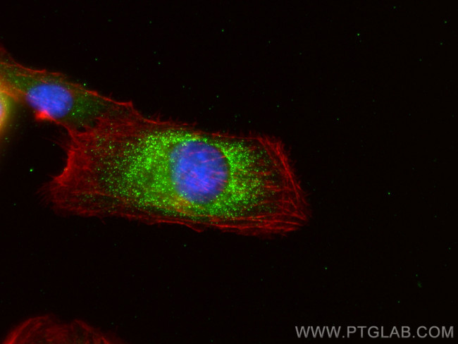 OTUB1 Antibody in Immunocytochemistry (ICC/IF)