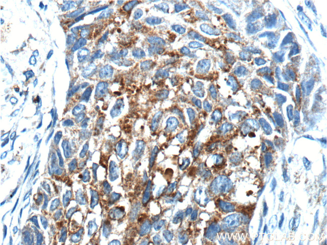 RPN2 Antibody in Immunohistochemistry (Paraffin) (IHC (P))