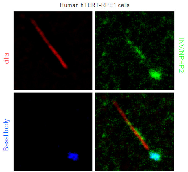 INVS Antibody in Immunocytochemistry (ICC/IF)