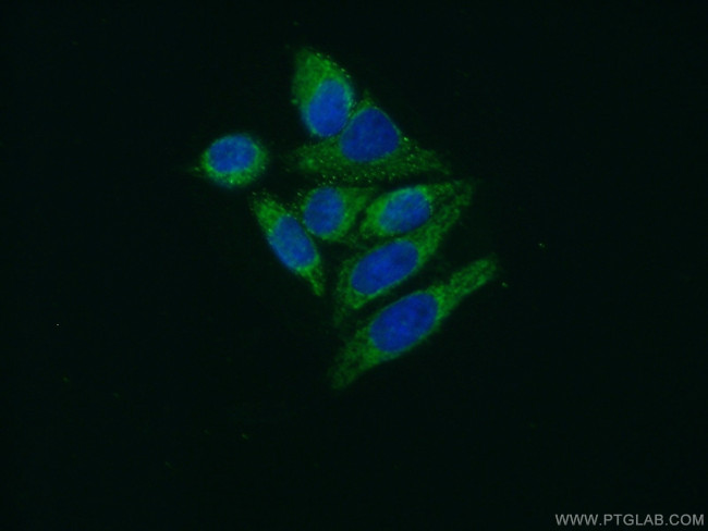 EXTL3 Antibody in Immunocytochemistry (ICC/IF)