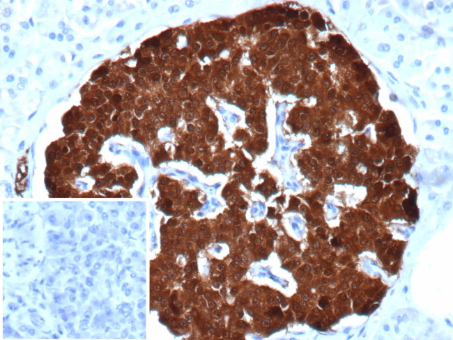 SCGN/Secretagogin Antibody in Immunohistochemistry (Paraffin) (IHC (P))