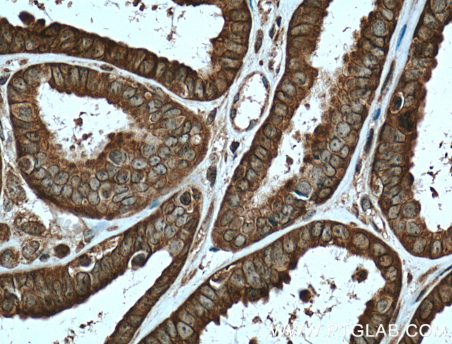APOBEC3C Antibody in Immunohistochemistry (Paraffin) (IHC (P))
