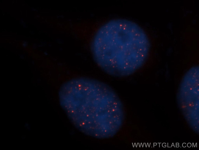 HEY2 Antibody in Immunocytochemistry (ICC/IF)
