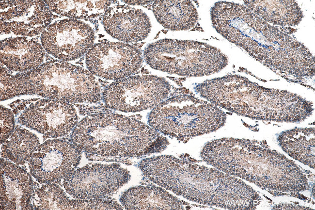 IFT81 Antibody in Immunohistochemistry (Paraffin) (IHC (P))