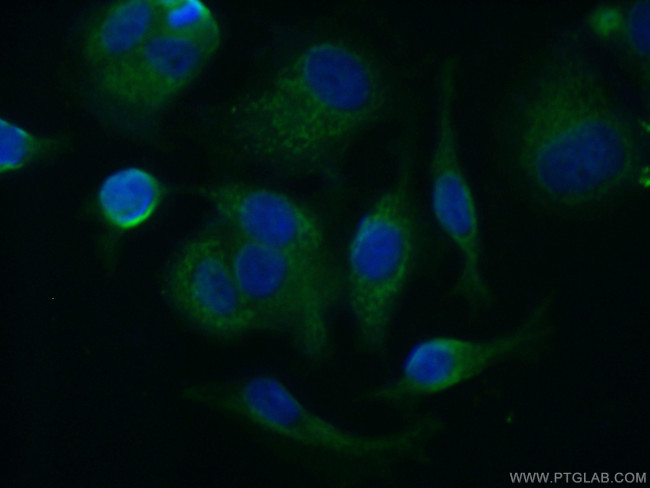 APOBEC3G Antibody in Immunocytochemistry (ICC/IF)