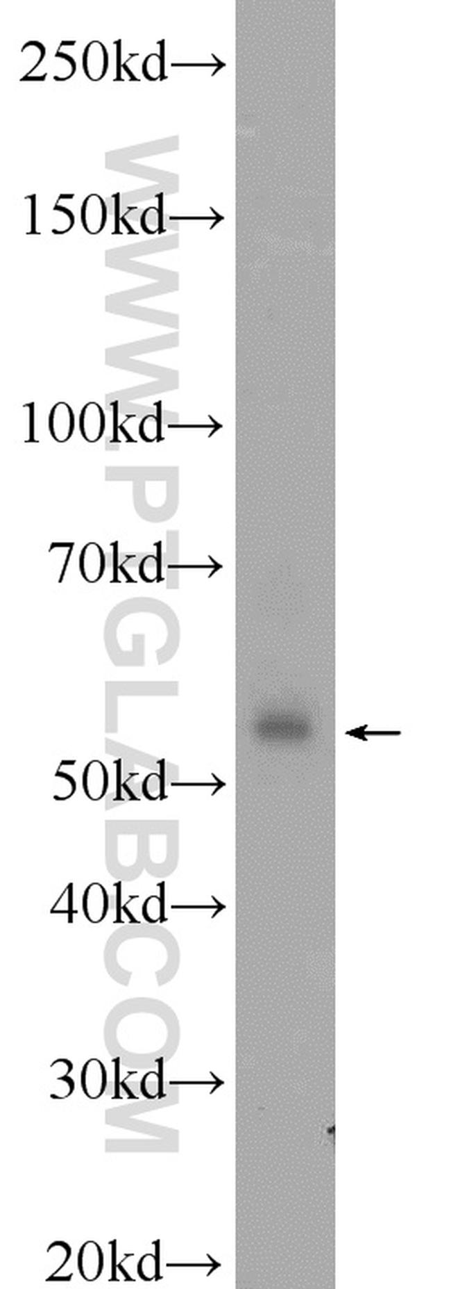 COX10 Antibody in Western Blot (WB)