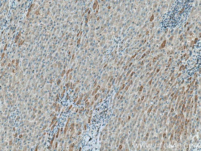 FBXO44 Antibody in Immunohistochemistry (Paraffin) (IHC (P))