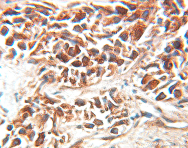 EEF1D Antibody in Immunohistochemistry (Paraffin) (IHC (P))