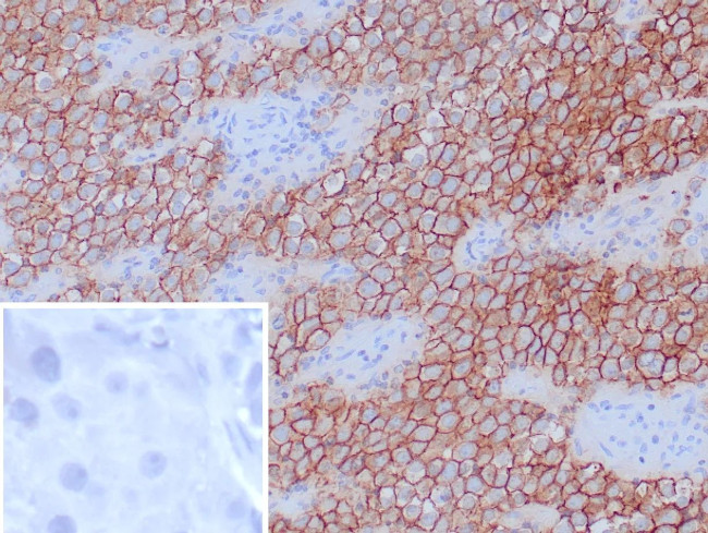 Podoplanin (PDPN) (Lymphatic Endothelial and Mesothelial Marker) Antibody in Immunohistochemistry (Paraffin) (IHC (P))