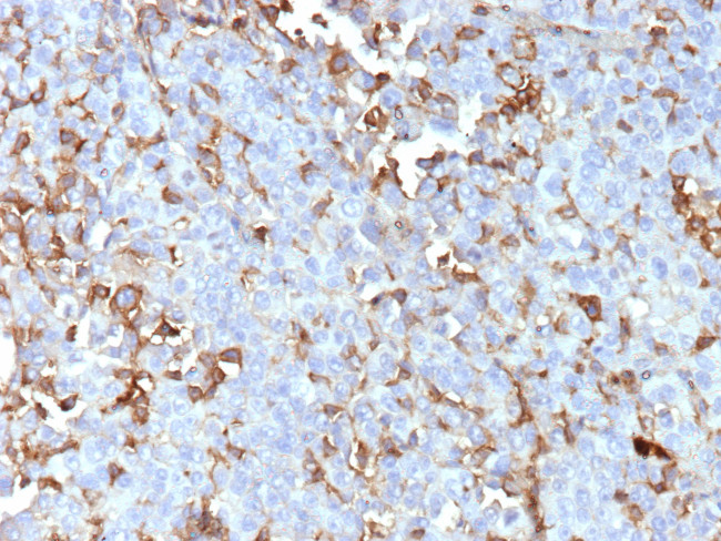 Periostin (POSTN) Antibody in Immunohistochemistry (Paraffin) (IHC (P))
