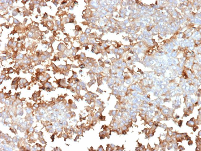 Periostin (POSTN) Antibody in Immunohistochemistry (Paraffin) (IHC (P))