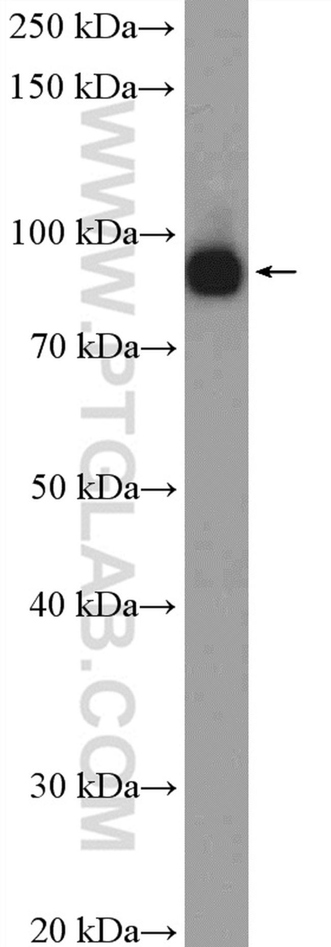 XAB2 Antibody in Western Blot (WB)