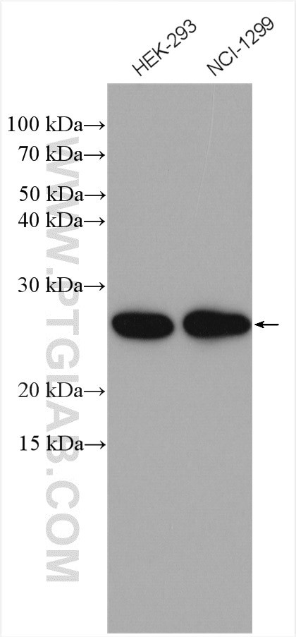 EIF3K Antibody in Western Blot (WB)