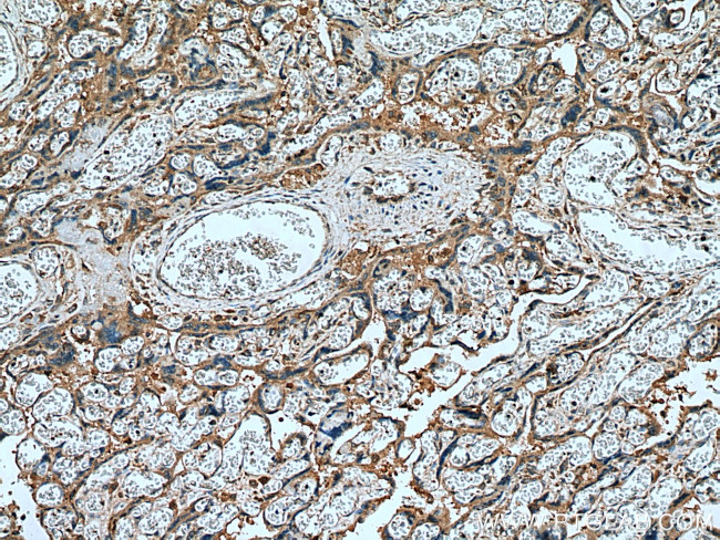 Placental Growth Factor Antibody in Immunohistochemistry (Paraffin) (IHC (P))