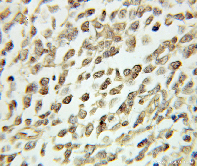 CDC25B Antibody in Immunohistochemistry (Paraffin) (IHC (P))