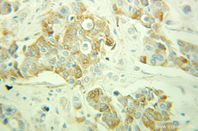 ARPC1B Antibody in Immunohistochemistry (Paraffin) (IHC (P))