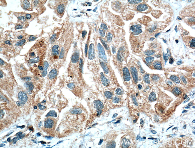 HIF1AN Antibody in Immunohistochemistry (Paraffin) (IHC (P))