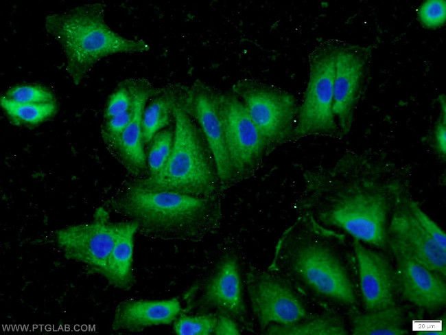 Inhibin beta A Antibody in Immunocytochemistry (ICC/IF)