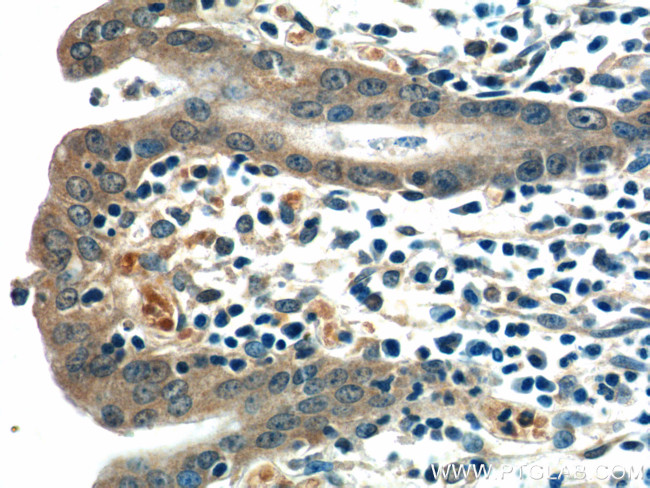 Ajuba Antibody in Immunohistochemistry (Paraffin) (IHC (P))