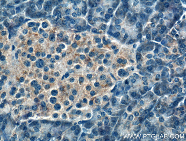 FBXW4 Antibody in Immunohistochemistry (Paraffin) (IHC (P))