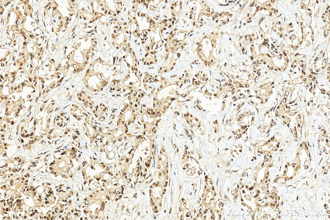 HNRPDL Antibody in Immunohistochemistry (Paraffin) (IHC (P))