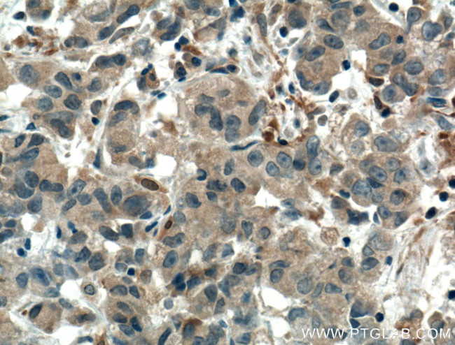 SULT1C2 Antibody in Immunohistochemistry (Paraffin) (IHC (P))
