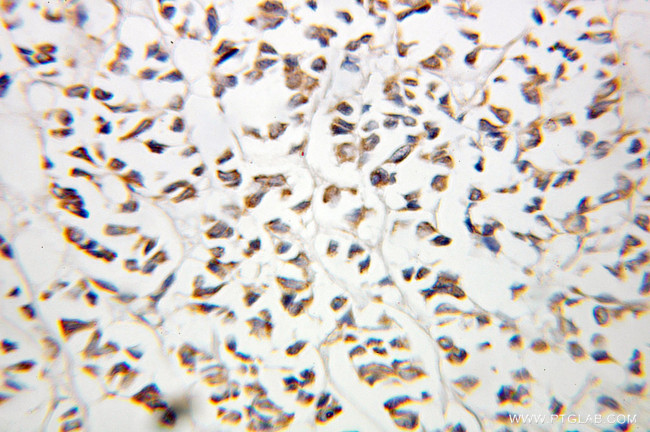 OSTF1 Antibody in Immunohistochemistry (Paraffin) (IHC (P))