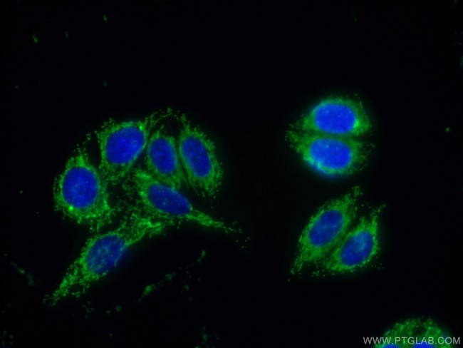 Protein C inhibitor Antibody in Immunocytochemistry (ICC/IF)