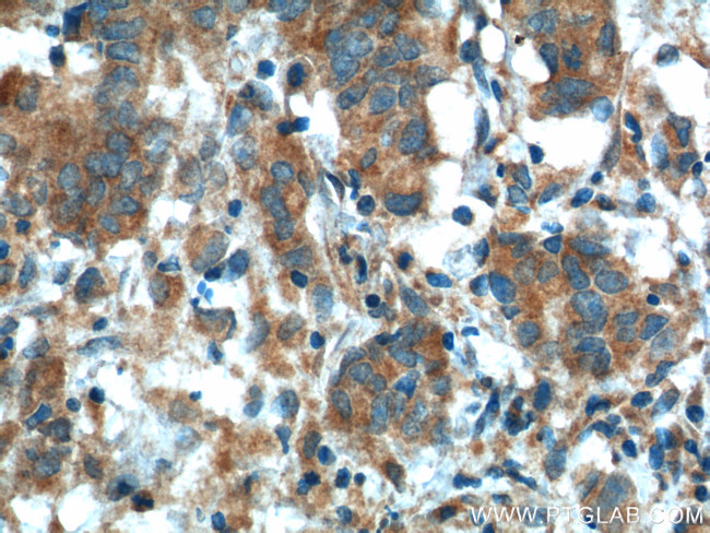 KLK3/PSA Antibody in Immunohistochemistry (Paraffin) (IHC (P))