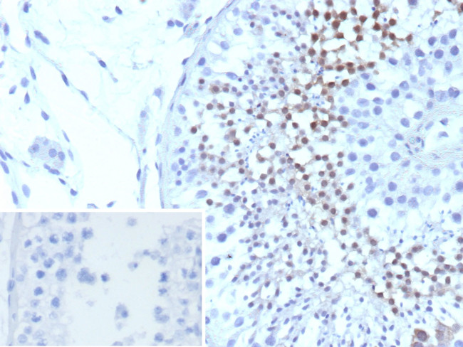 CETN1/Centrin-1 Antibody in Immunohistochemistry (Paraffin) (IHC (P))
