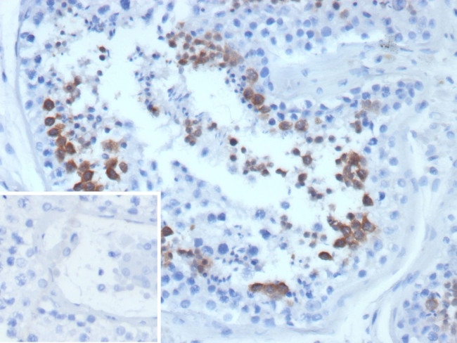 CETN1/Centrin-1 Antibody in Immunohistochemistry (Paraffin) (IHC (P))