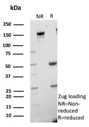 CETN1/Centrin-1 Antibody in SDS-PAGE (SDS-PAGE)