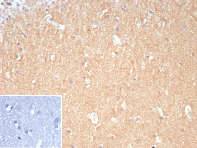 DLL3/SCDO1 Antibody in Immunohistochemistry (Paraffin) (IHC (P))