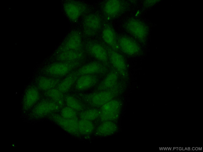 MBIP Antibody in Immunocytochemistry (ICC/IF)