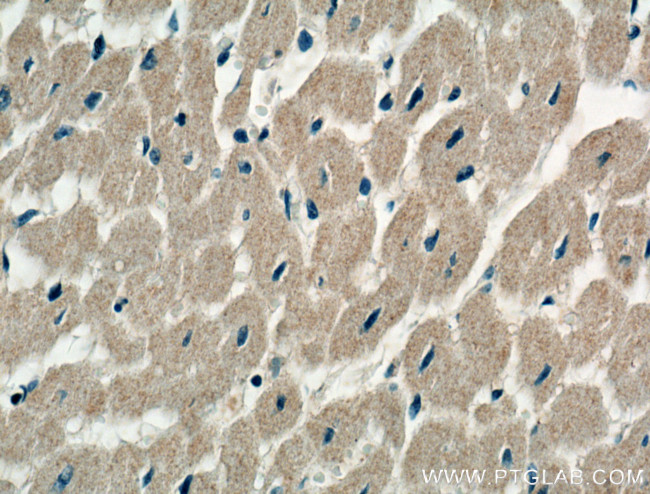 STRADB Antibody in Immunohistochemistry (Paraffin) (IHC (P))