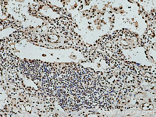 RPA3 Antibody in Immunohistochemistry (Paraffin) (IHC (P))