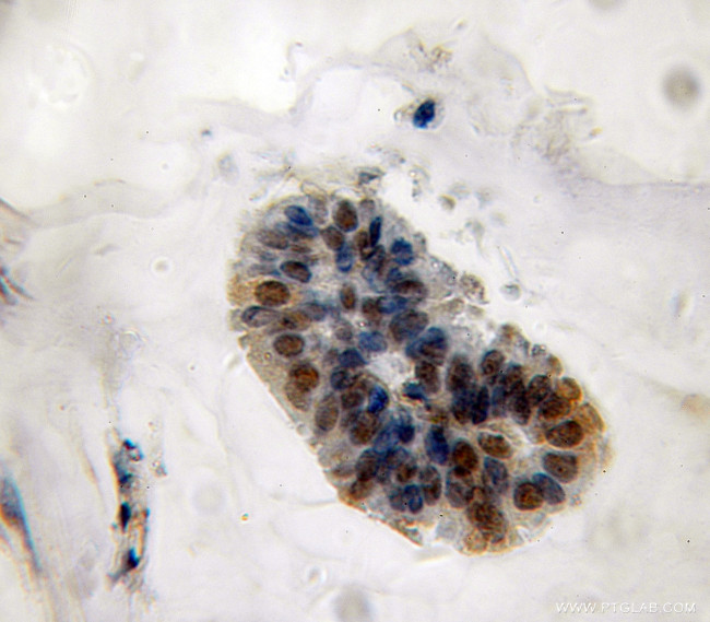 MPHOSPH6 Antibody in Immunohistochemistry (Paraffin) (IHC (P))