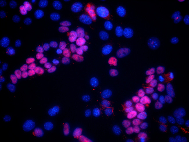 SIX1 Antibody in Immunocytochemistry (ICC/IF)