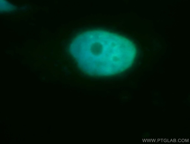 Cyclin H Antibody in Immunocytochemistry (ICC/IF)